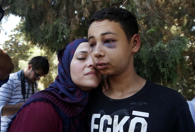fot. Ronen Zvulun / Reuters / 6 czerwca 2014  Jerozolima, Izrael  Tariq Khdeir witany przez swoją matkę po wyjściu z jerozolimskiego więzienia.